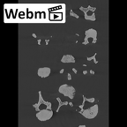 KNM-WT 15000 Homo erectus vertebrae and ribs medical ct stack movie