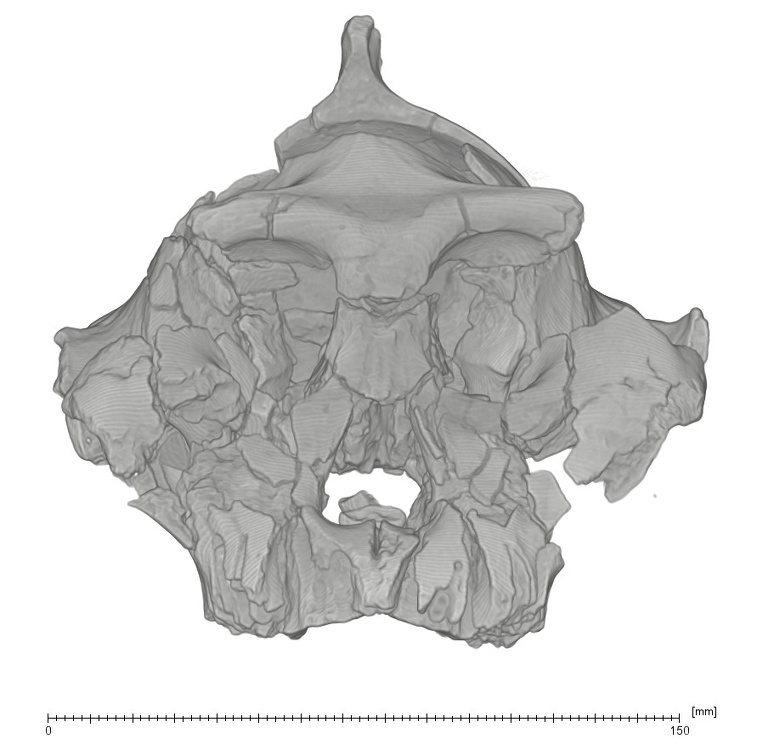 KNM-WT 17000 Paranthropus aethiopicus cranium medical ct anterior