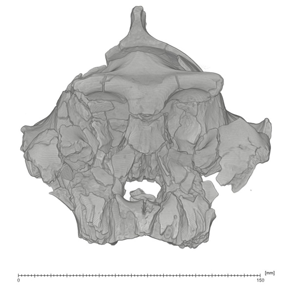 KNM-WT 17000 Paranthropus aethiopicus cranium medical ct anterior