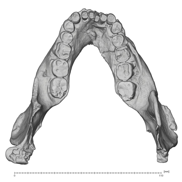 KNM-WT 60000 Homo rudolfensis mandible medical ct superior