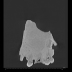 KNM-WT 62000 Homo rudolfensis maxilla medical ct ct slice