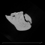 KNM BK 67 Homo erectus mandible high res ct slice