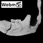 KNM-BK 67 Homo erectus mandible overview ct stack movie