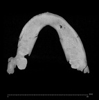 KNM-BK 8518 Homo erectus mandible overview ct slice