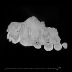KNM-CH1B Paranthropus boisei right maxilla ct slice