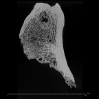 KNM-ER 1465A Hominin left proximal femur ct slice