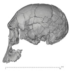 KNM-ER 1470 Homo rudolfensis cranium lateral