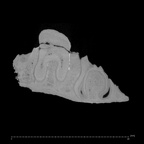 KNM-ER 1502 Homo sp. partial mandible ct slice