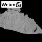 KNM-ER 1502 Homo sp. partial mandible ct stack movie