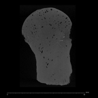 KNM-ER 1505A Hominin left proximal femur ct slice
