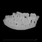 KNM-ER 15930 Paranthropus boisei partial mandible ct slice