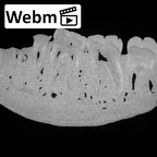 KNM-ER 15930 Paranthropus boisei partial mandible ct stack movie