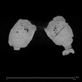 KNM-ER 1805 Homo habilis mandible ct slice