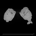 KNM-ER 1805 Homo habilis mandible ct slice