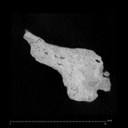 KNM-ER 1805 Homo habilis occipital fragment ct slice