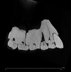 KNM-ER 1813 Homo habilis maxilla ct slice