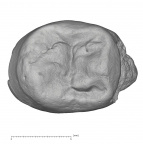 KNM-ER 18539 Australopithecus anamensis URP3 occlusal
