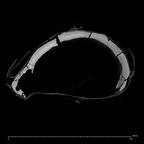 KNM-ER 23000 Paranthropus boisei cranium ct slice