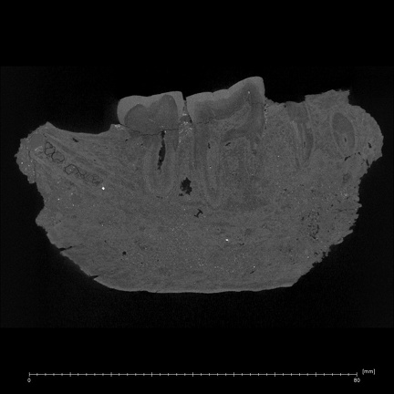 KNM-ER 25520 Paranthropus boisei partial mandible ct slice