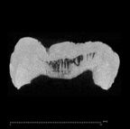 KNM-ER 30201 Australopithecus anamensis LLM1 ct slice