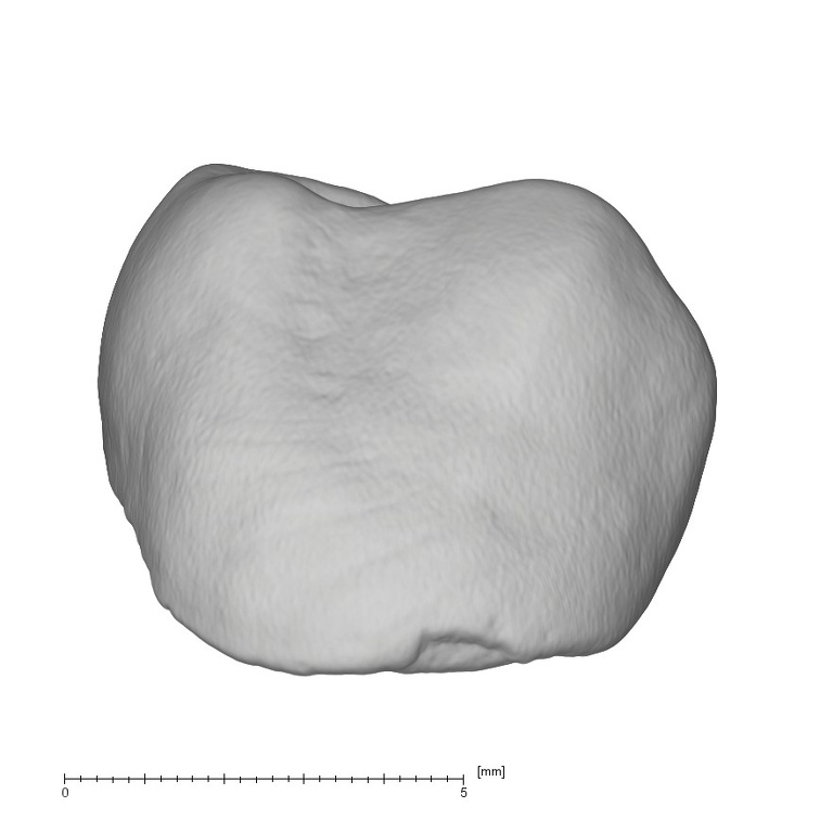 KNM-ER 35228 Australopithecus anamensis LRP4 buccal