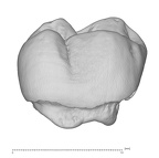KNM-ER 35231 Australopithecus anamensis URM buccal