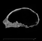 KNM-ER 3883 Homo erectus cranium ct slice