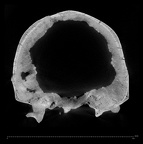 KNM-ER 42700 Homo erectus cranium ct slice