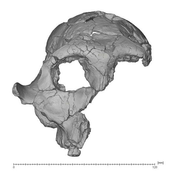 KNM-ER 732A Paranthropus boisei cranium anterior