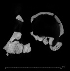 KNM-ER 732A Paranthropus boisei cranium ct slice