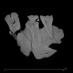 KNM-ER 807 Homo sp. right partial maxilla ct slice
