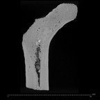 KNM-ER 815 Hominin left proximal femur ct slice