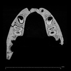 KNM-ER 820 Homo erectus mandible ct slice
