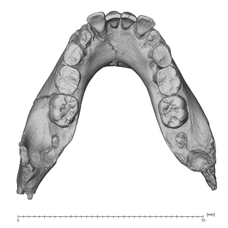 KNM-ER 820 Homo erectus mandible superior