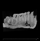 KNM-ER 992A Homo erectus partial mandible high res ct slice