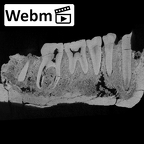 KNM-ER 992A Homo erectus partial mandible high res ct stack movie