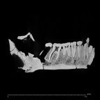 KNM-ER 992B Homo erectus partial mandible ct slice
