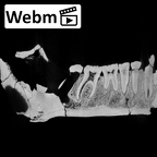 KNM-ER 992B Homo erectus partial mandible ct stack movie