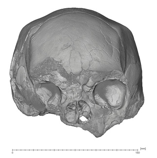 KNM-ES 11693 Homo sp. cranium anterior