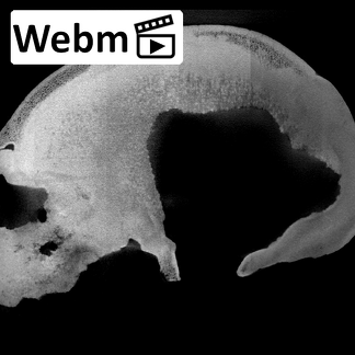KNM-ES 11693 Homo sp. cranium ct stack movie
