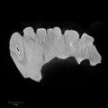 KNM-KP 29283 Australopithecus anamensis left maxilla ct slice