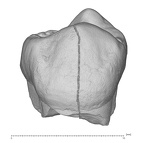 KNM-KP 29286B Australopithecus anamensis LRP4 buccal