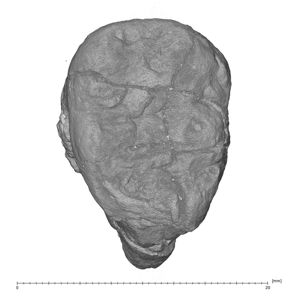 KNM-KP 30500E Australopithecus anamensis LRM3 occlusal