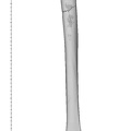 KNM-WT 15000F Homo erectus right humerus posterior