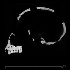 KNM-WT 15000A Homo erectus cranium ct slice
