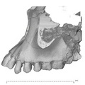 KNM-WT 15000A Homo erectus maxilla lateral
