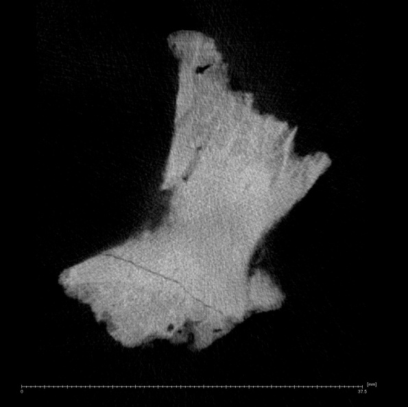 KNM-WT 15000BG Homo erectus left os coxae fragment ct slice