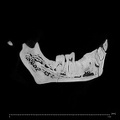 KNM-WT 15000B Homo erectus mandible overview ct slice