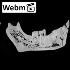KNM-WT 15000B Homo erectus mandible overview ct stack movie