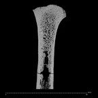 KNM-WT 15000F H. erectus right proximal humerus ct slice